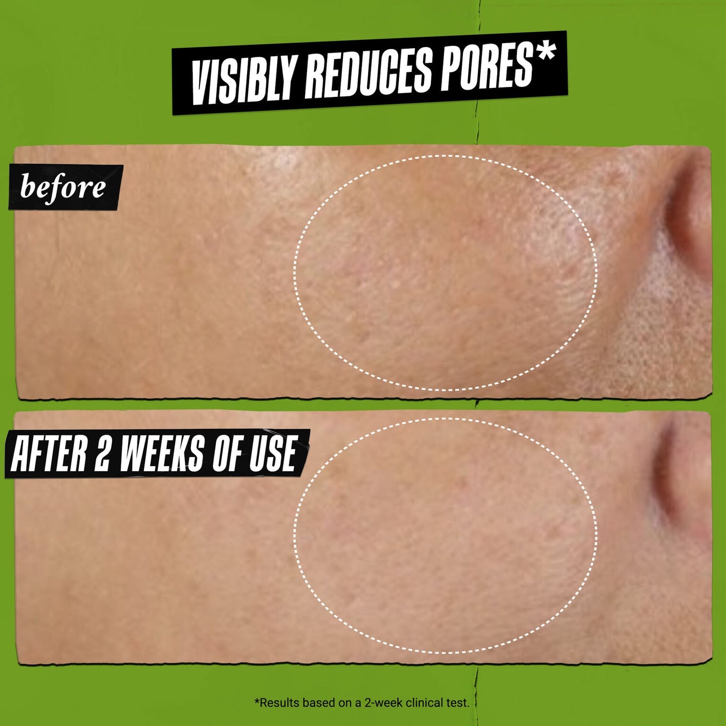 Rare Earth Deep Pore Minimizing Clay Mask 4.2 fl oz/ 125 ml
